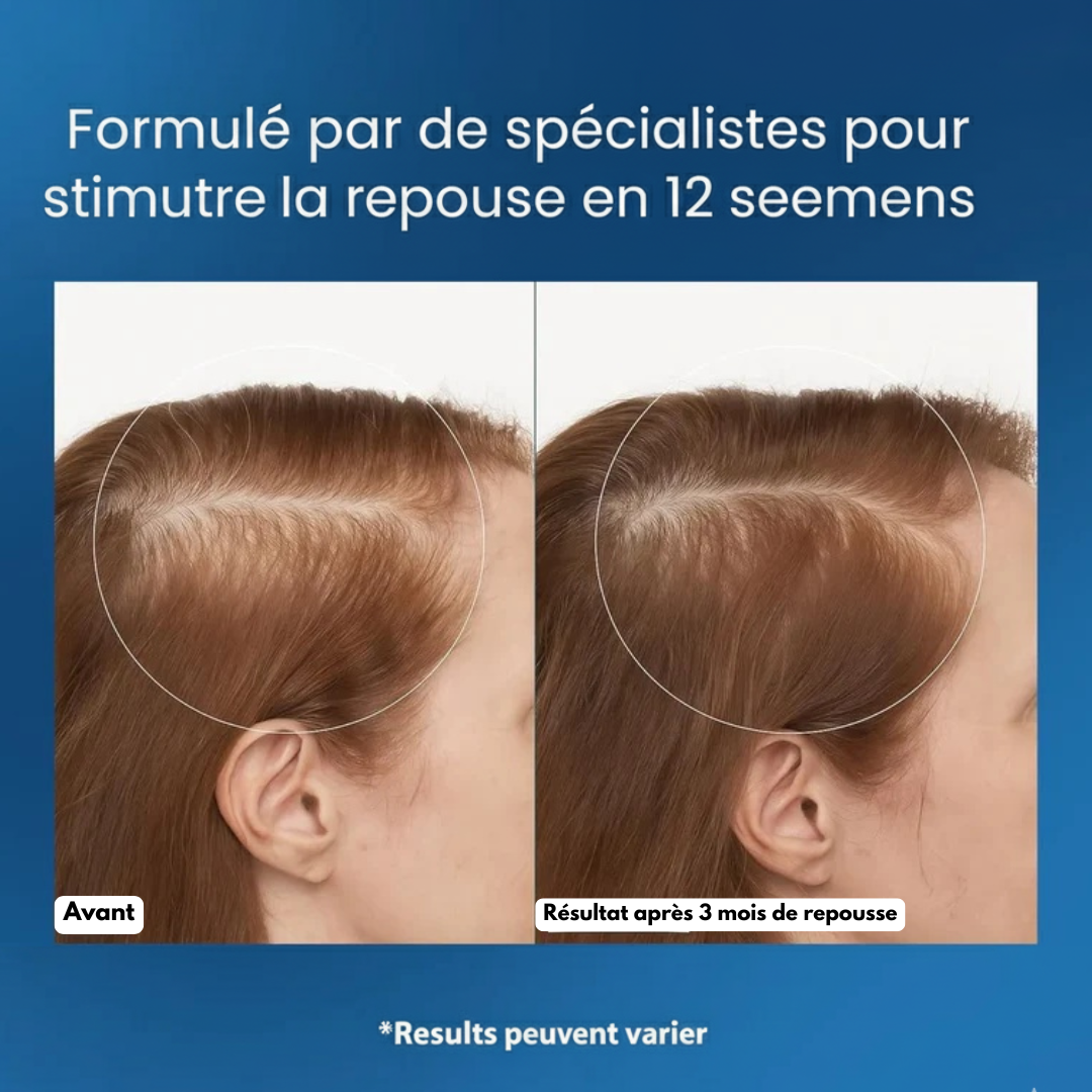 Renaître™ | Sérum Roll-On Repousse & Densité